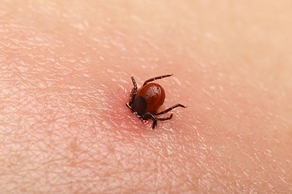 tick control